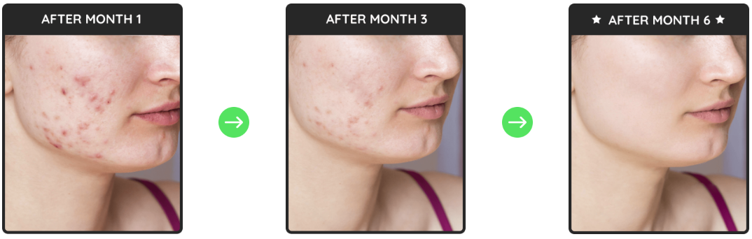 PrimeBiome™ user transformation