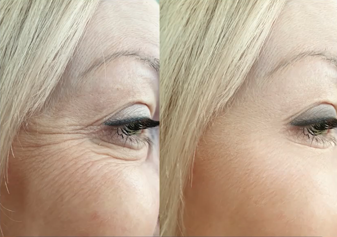 Camila M. transformation